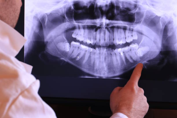 Best Emergency Dentist for Lost Fillings or Crowns in Lincoln, AL