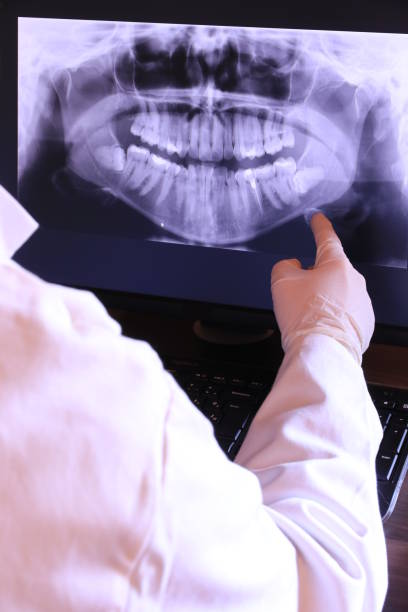 Best Emergency Dental Care for Abscessed Tooth in Lincoln, AL